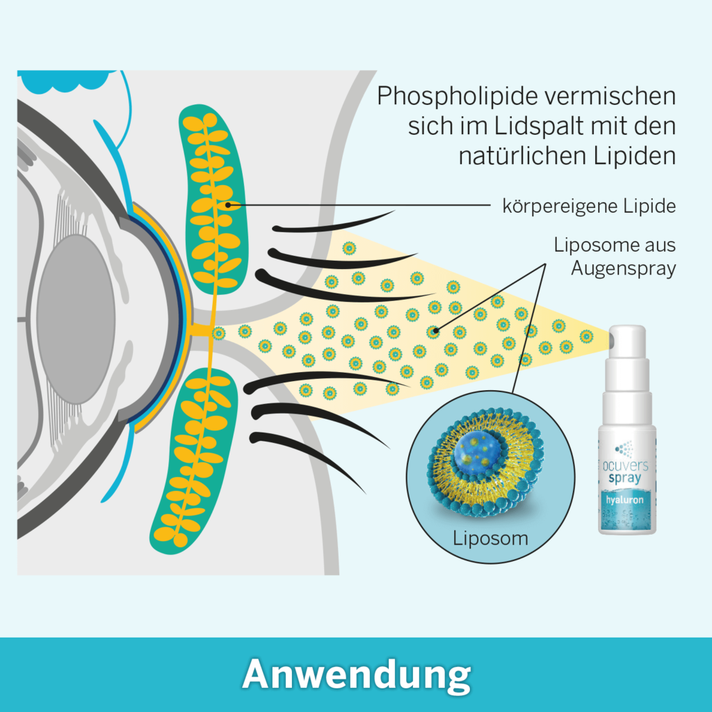 Augenspray Anwendung